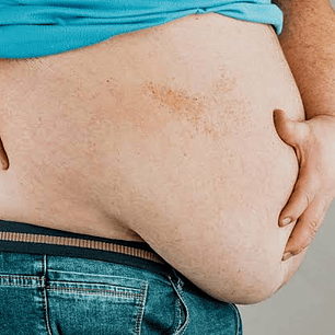 Receta evaluación control peso (electrónica)