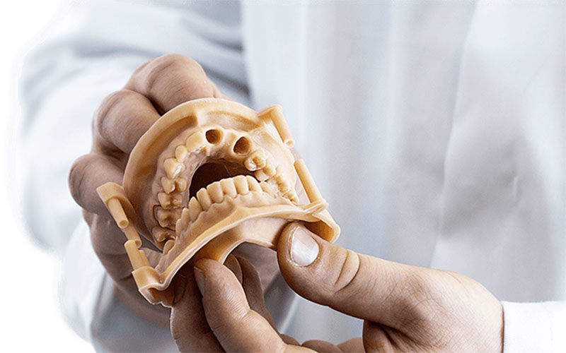 Impresión 3D de precisión para odontología digital