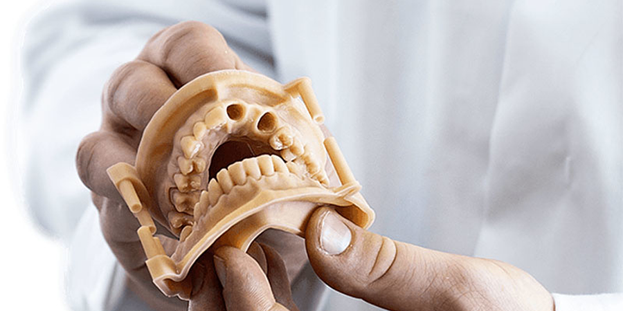 Impresión 3D de precisión para odontología digital