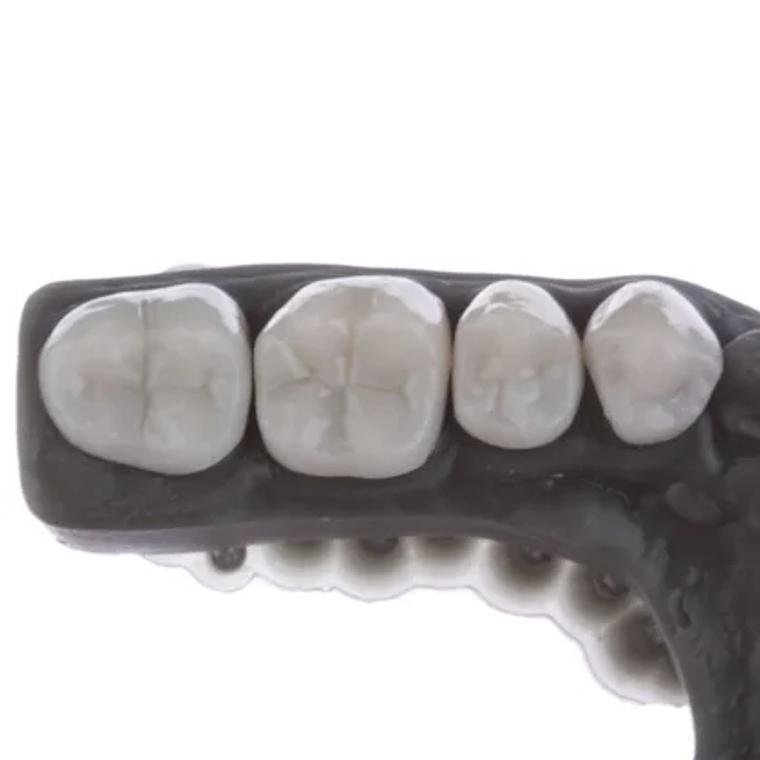 Resina Prizma BioCrown 4