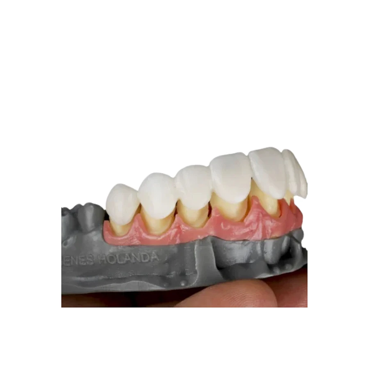 Resina Prizma BioProv 3