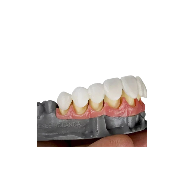 Resina Prizma Gingiva  2