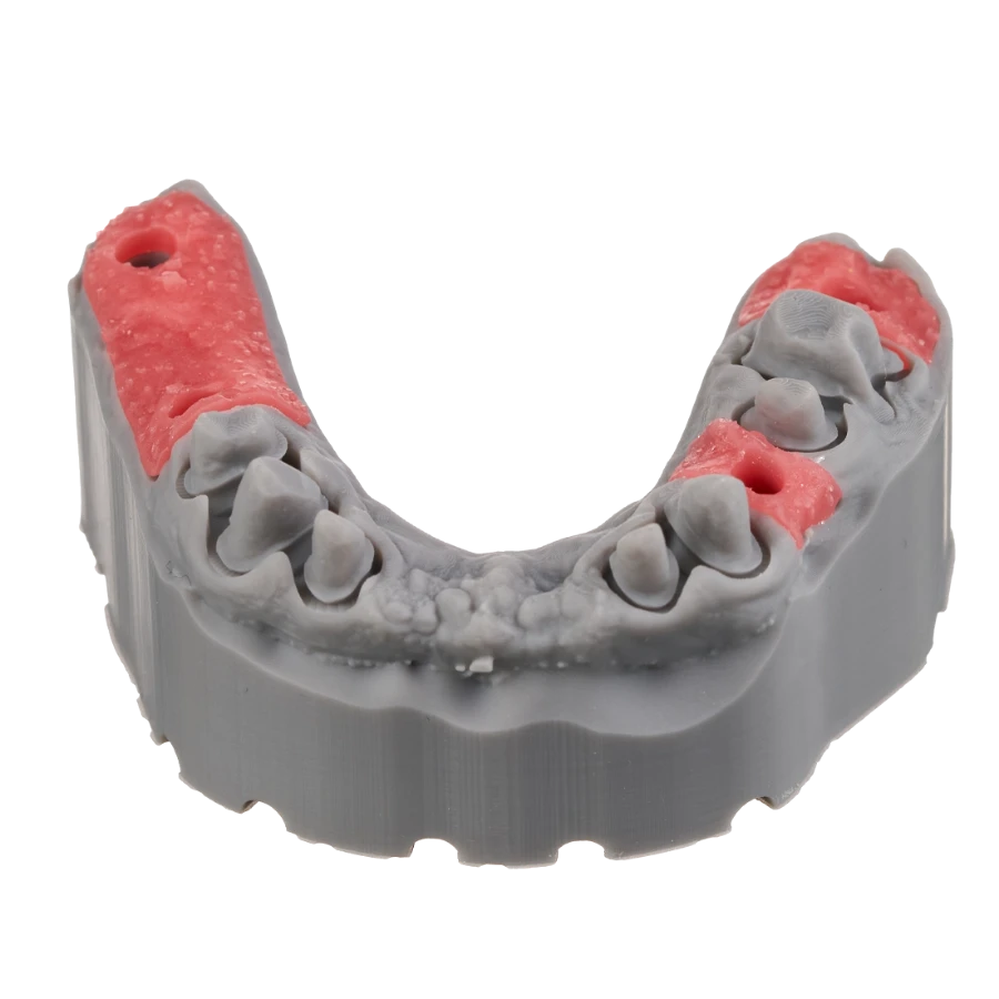 Segmento gingival impreso en 3D