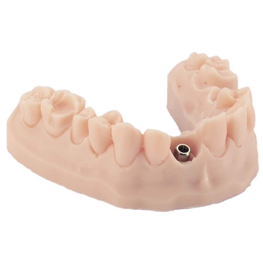 Modelo dental impreso en 3D