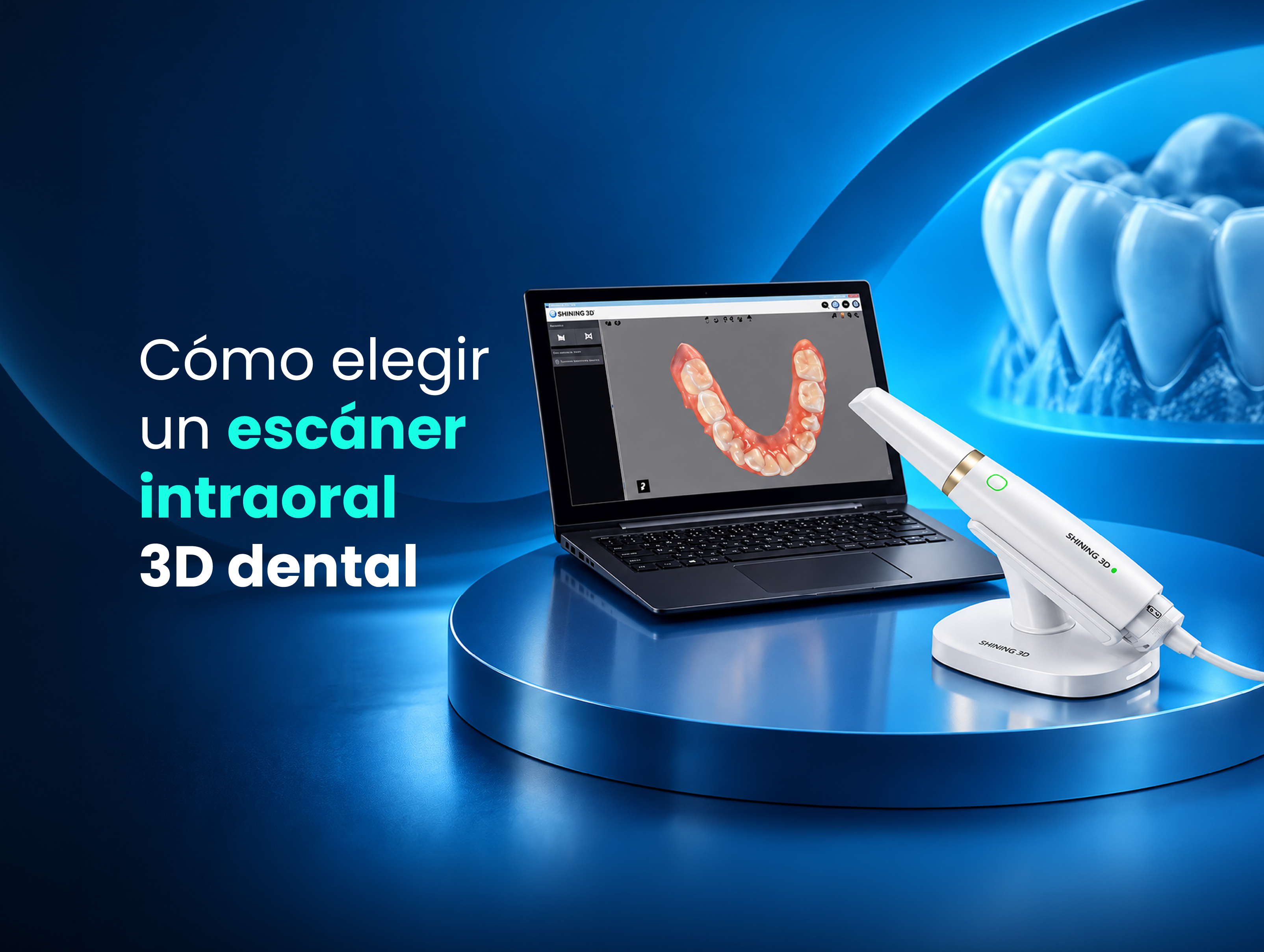 Cómo elegir un escáner intraoral 3D dental