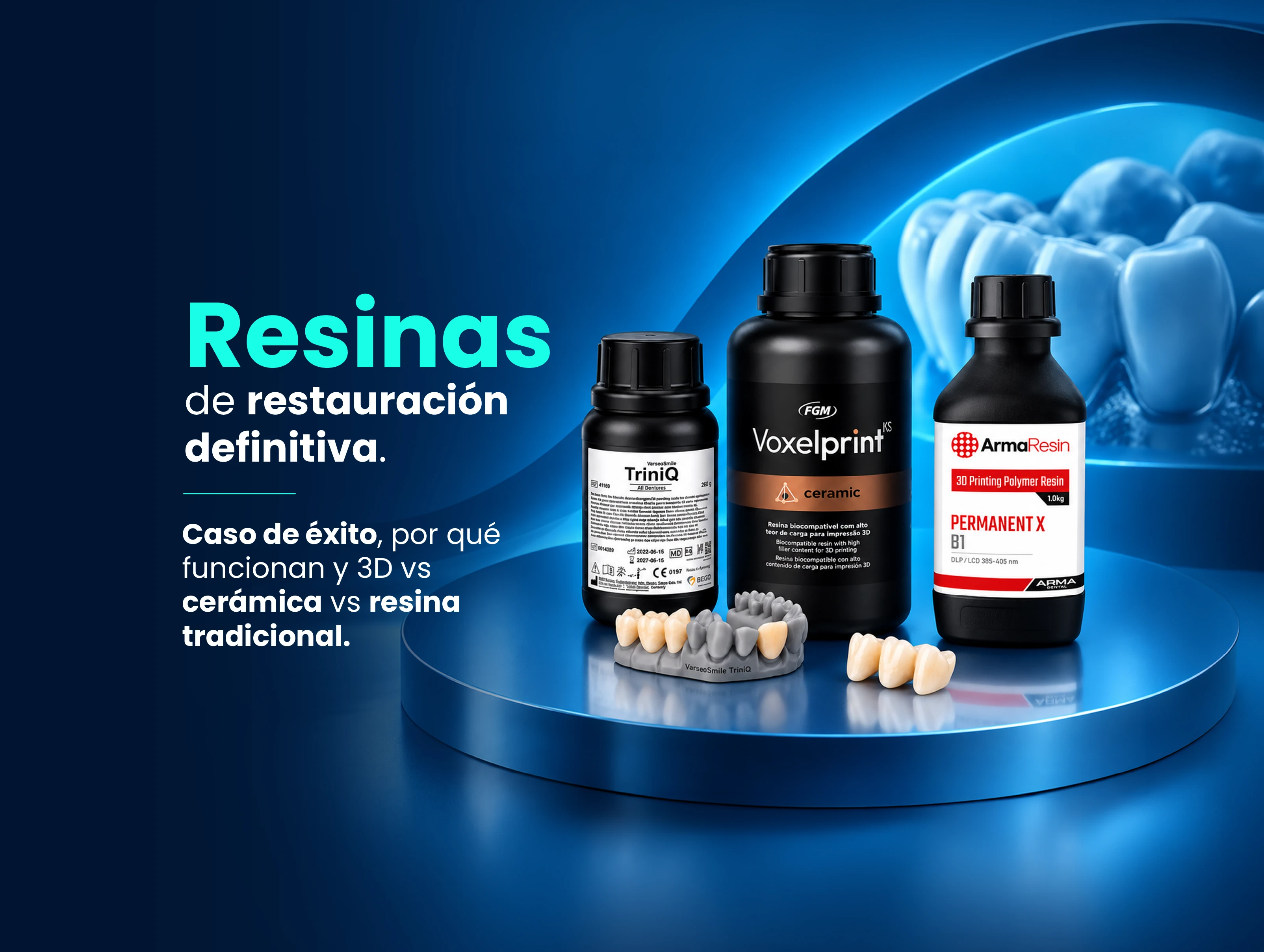 Resinas de restauración definitiva: caso de éxito, por qué funcionan y 3D vs cerámica vs resina tradicional