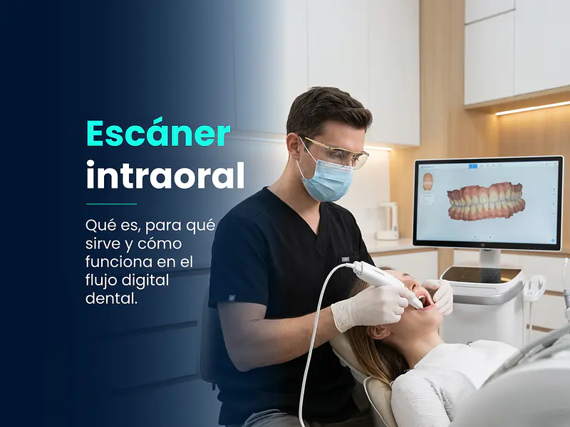 Escáner intraoral: qué es, para qué sirve y cómo funciona en el flujo digital dental