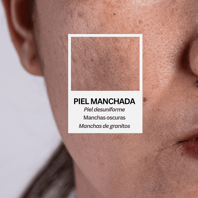 Rutina control de manchas