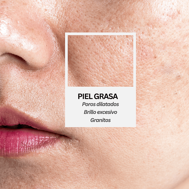 Rutina control oleosidad