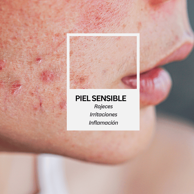Rutina piel sensible