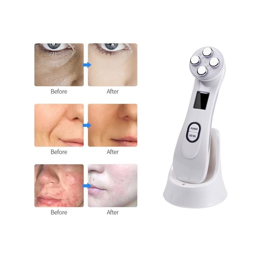 MASAJEADOR RADIOFRECUENCIA FACIAL PORTÁTIL - BEAUTY INTRUMENT 2