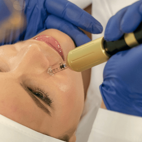 HYALURON PEN FACIAL 2 EN 1 - 0.3ML A 0.5ML