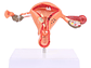 Modelo Anatómico Útero Y Ovarios Patológicos - Miniatura 1