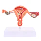 Modelo Anatómico Útero Y Ovarios Patológicos - Miniatura 1