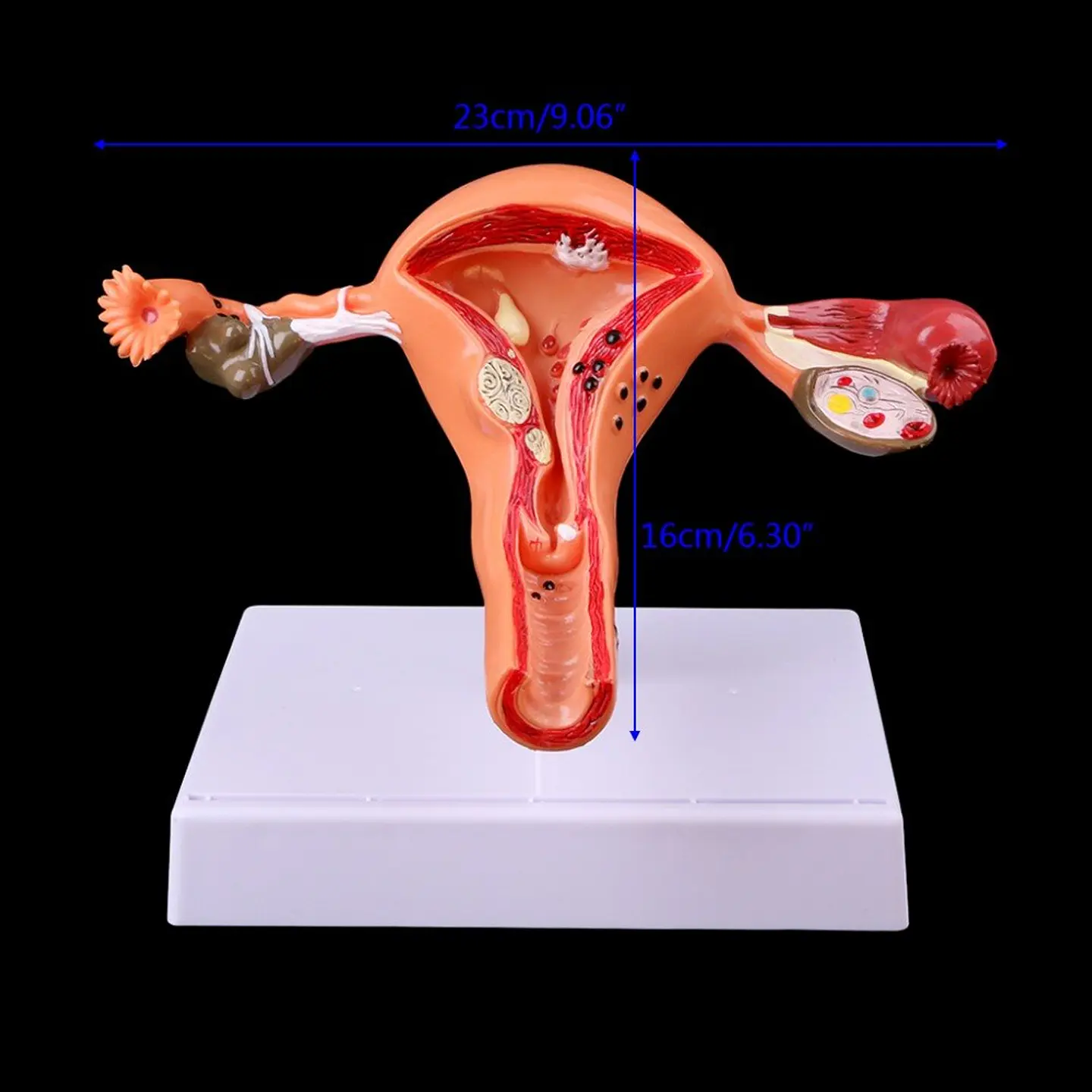 Modelo Anatómico Útero Y Ovarios Patológicos 3