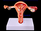 Modelo Anatómico Útero Y Ovarios Patológicos - Miniatura 3