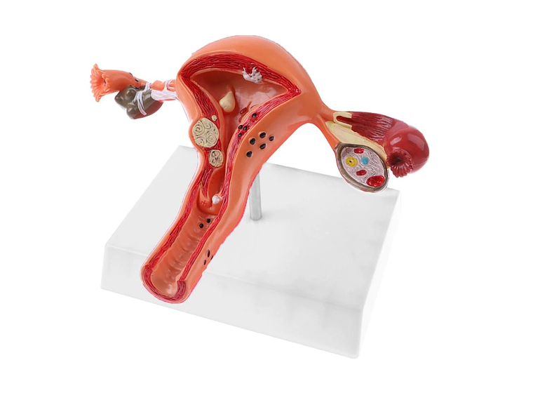 Modelo Anatómico Útero Y Ovarios Patológicos 5