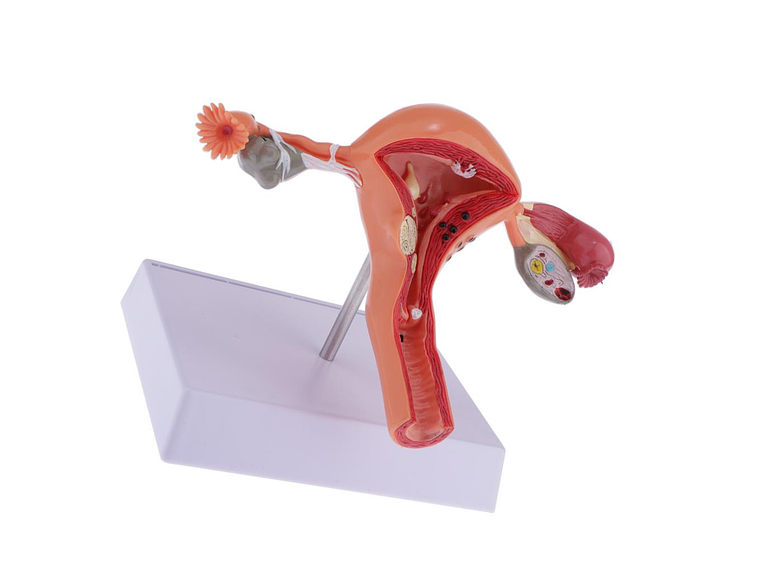 Modelo Anatómico Útero Y Ovarios Patológicos 7