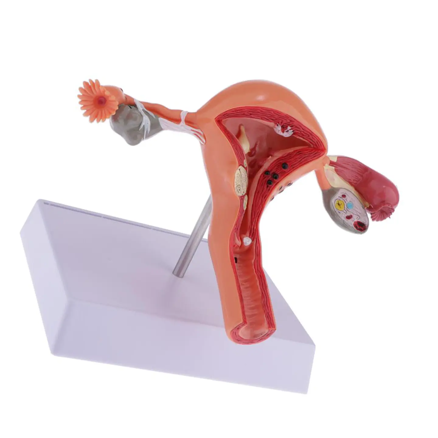 Modelo Anatómico Útero Y Ovarios Patológicos 7