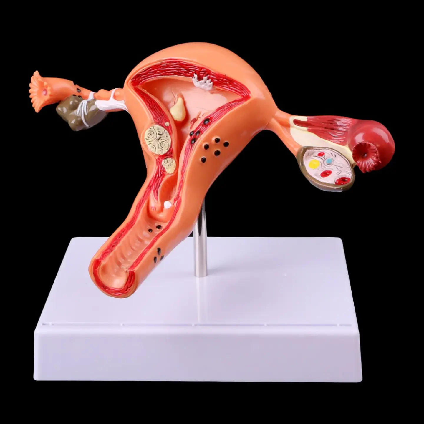 Modelo Anatómico Útero Y Ovarios Patológicos 8