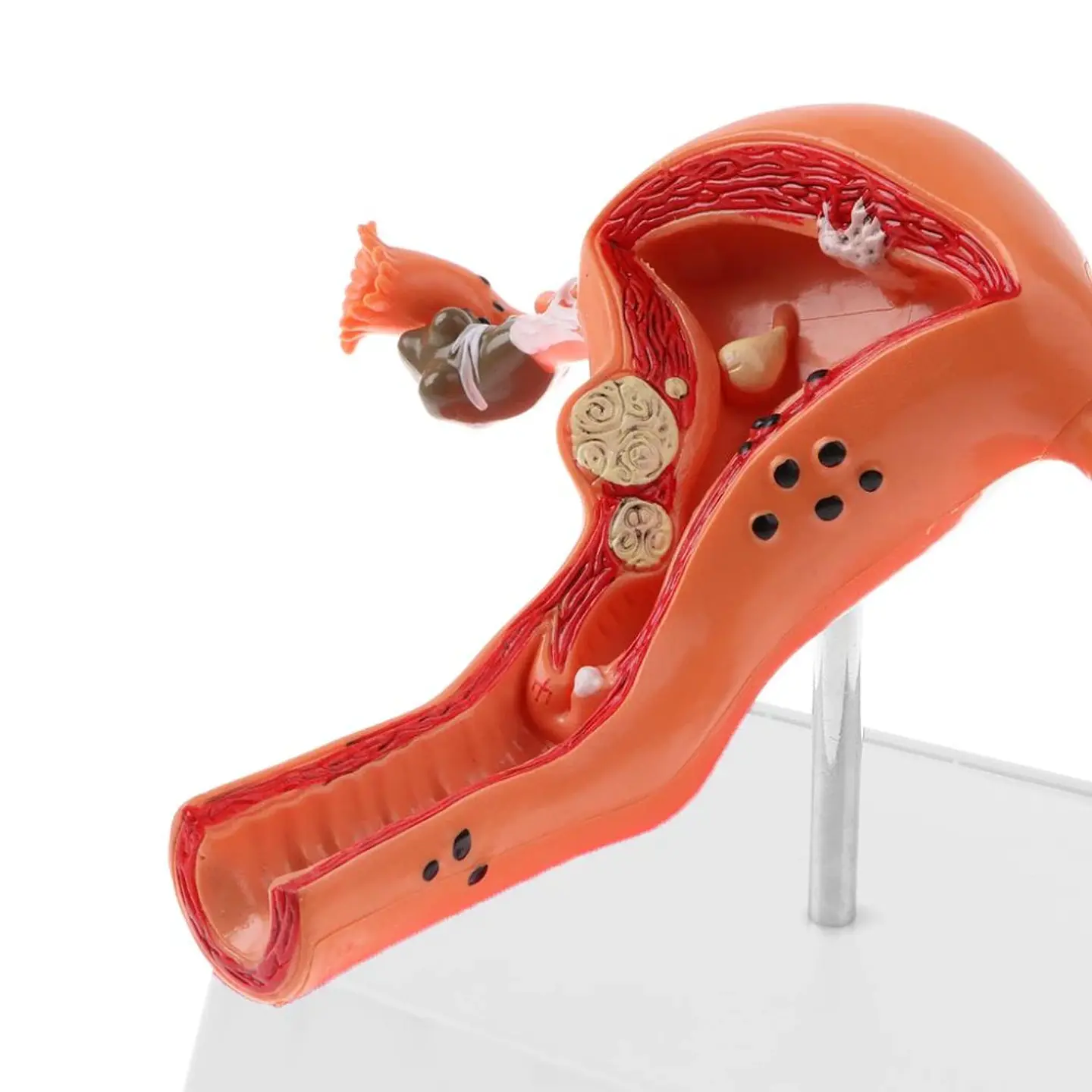 Modelo Anatómico Útero Y Ovarios Patológicos 11