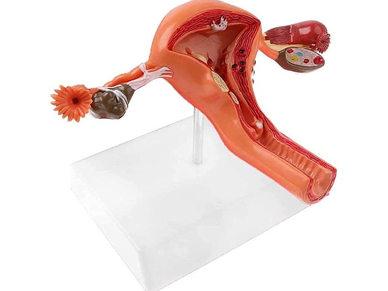 Modelo Anatómico Útero Y Ovarios Patológicos 13