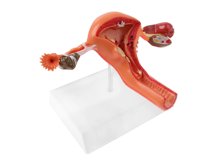 Modelo Anatómico Útero Y Ovarios Patológicos 14