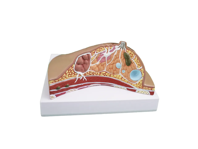 Modelo Anatómico De Mama Con Patologías Mas Comunes 1