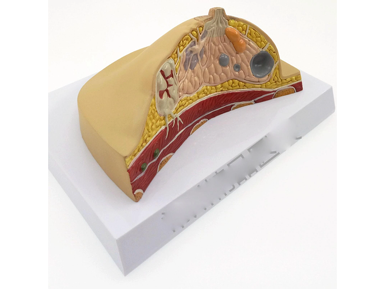 Modelo Anatómico De Mama Con Patologías Mas Comunes 3