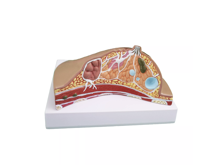 Modelo Anatómico De Mama Con Patologías Mas Comunes 4