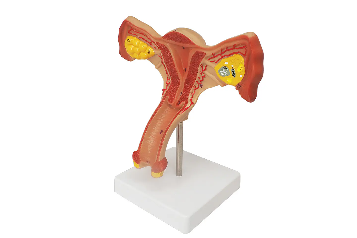 Modelo Anatómico Útero Y Ovarios Fisiológicos 1