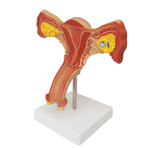Modelo Anatómico Útero Y Ovarios Fisiológicos