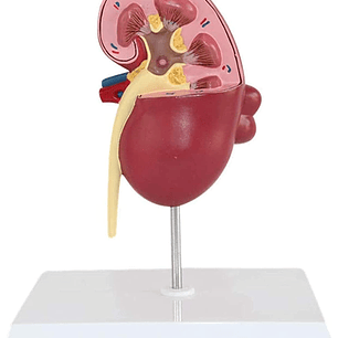 Modelo Anatómico Riñón Patologías