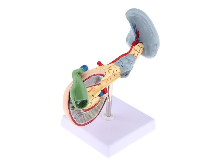 Modelo Patológico De Páncreas Vesícula Duodeno Bazo 2