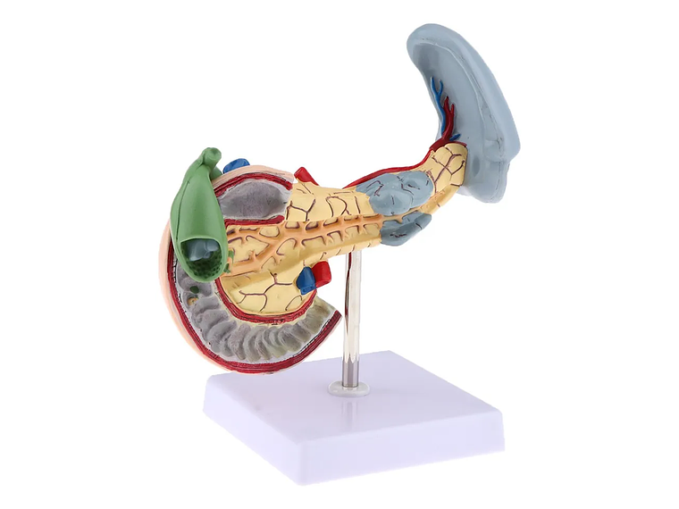Modelo Patológico De Páncreas Vesícula Duodeno Bazo 3