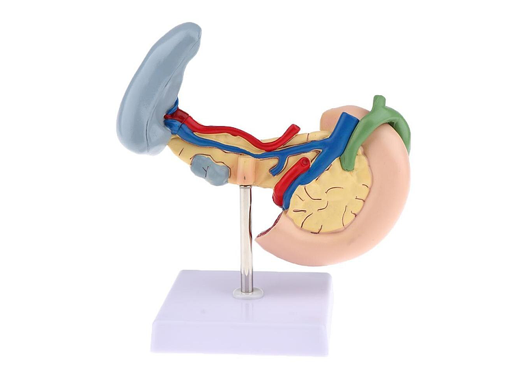 Modelo Patológico De Páncreas Vesícula Duodeno Bazo 4