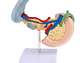 Modelo Patológico De Páncreas Vesícula Duodeno Bazo - Miniatura 4