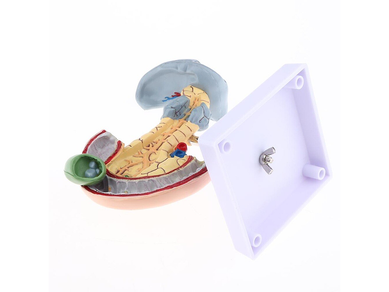 Modelo Patológico De Páncreas Vesícula Duodeno Bazo 5