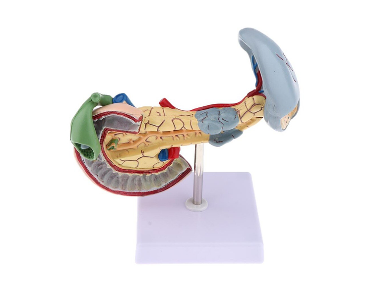 Modelo Patológico De Páncreas Vesícula Duodeno Bazo 6