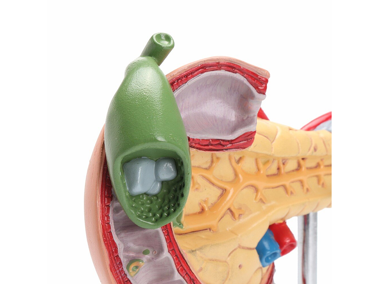 Modelo Patológico De Páncreas Vesícula Duodeno Bazo 7