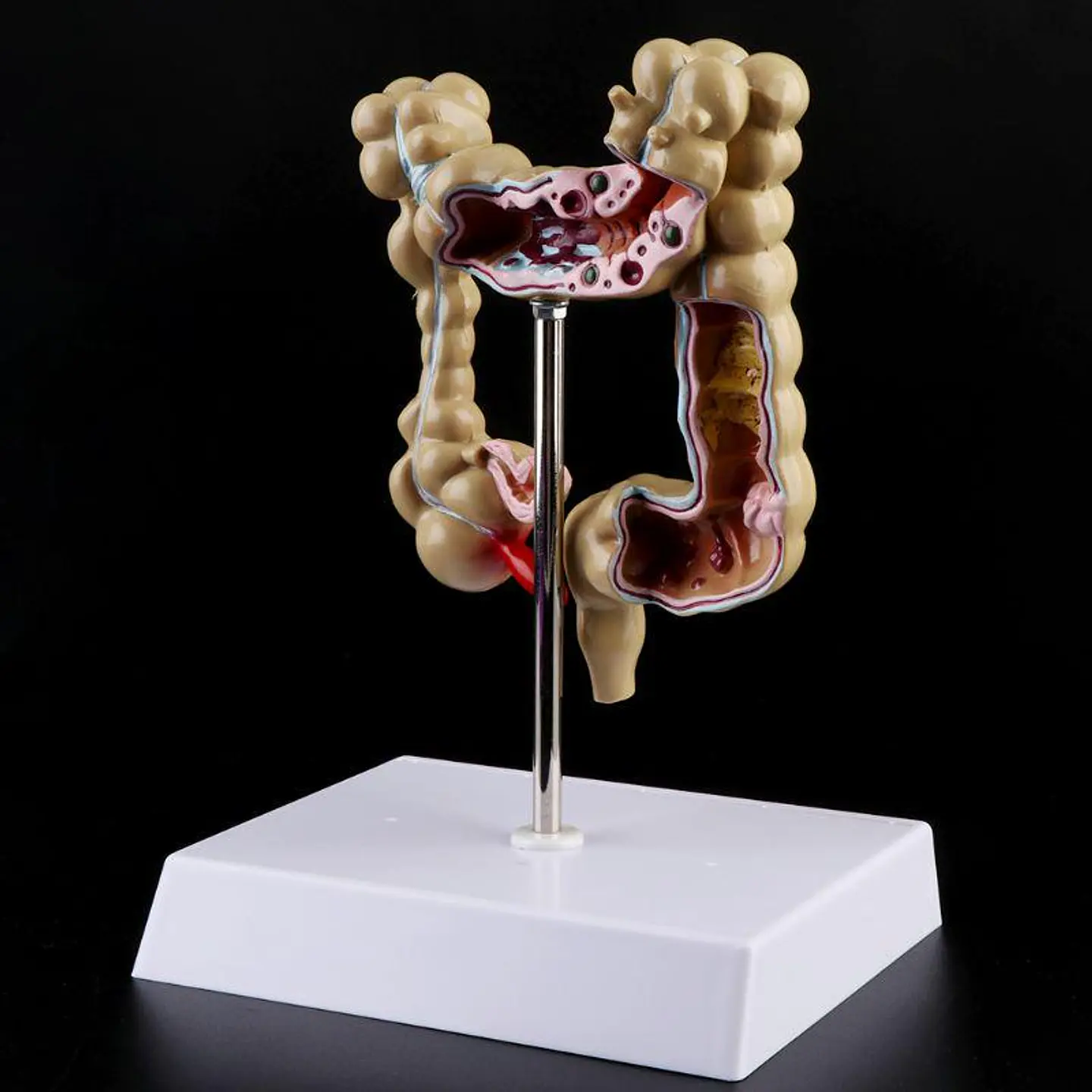 Maqueta Modelo Anatómico Colon Recto Patologías Más Comunes 2
