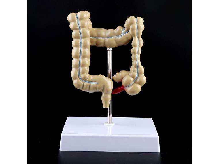 Maqueta Modelo Anatómico Colon Recto Patologías Más Comunes 3