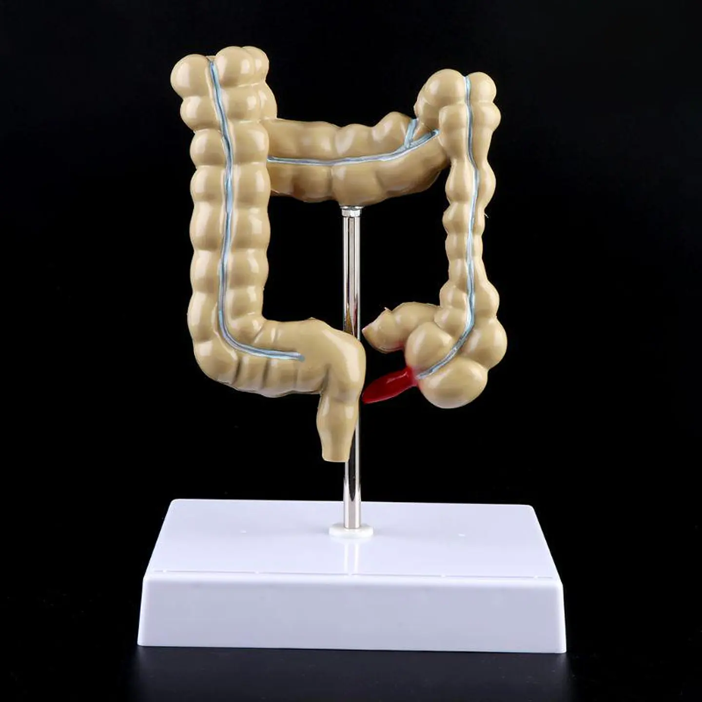 Maqueta Modelo Anatómico Colon Recto Patologías Más Comunes 3