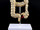 Maqueta Modelo Anatómico Colon Recto Patologías Más Comunes - Miniatura 3
