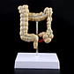 Maqueta Modelo Anatómico Colon Recto Patologías Más Comunes - Miniatura 3