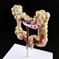 Maqueta Modelo Anatómico Colon Recto Patologías Más Comunes - Miniatura 4