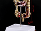 Maqueta Modelo Anatómico Colon Recto Patologías Más Comunes - Miniatura 6