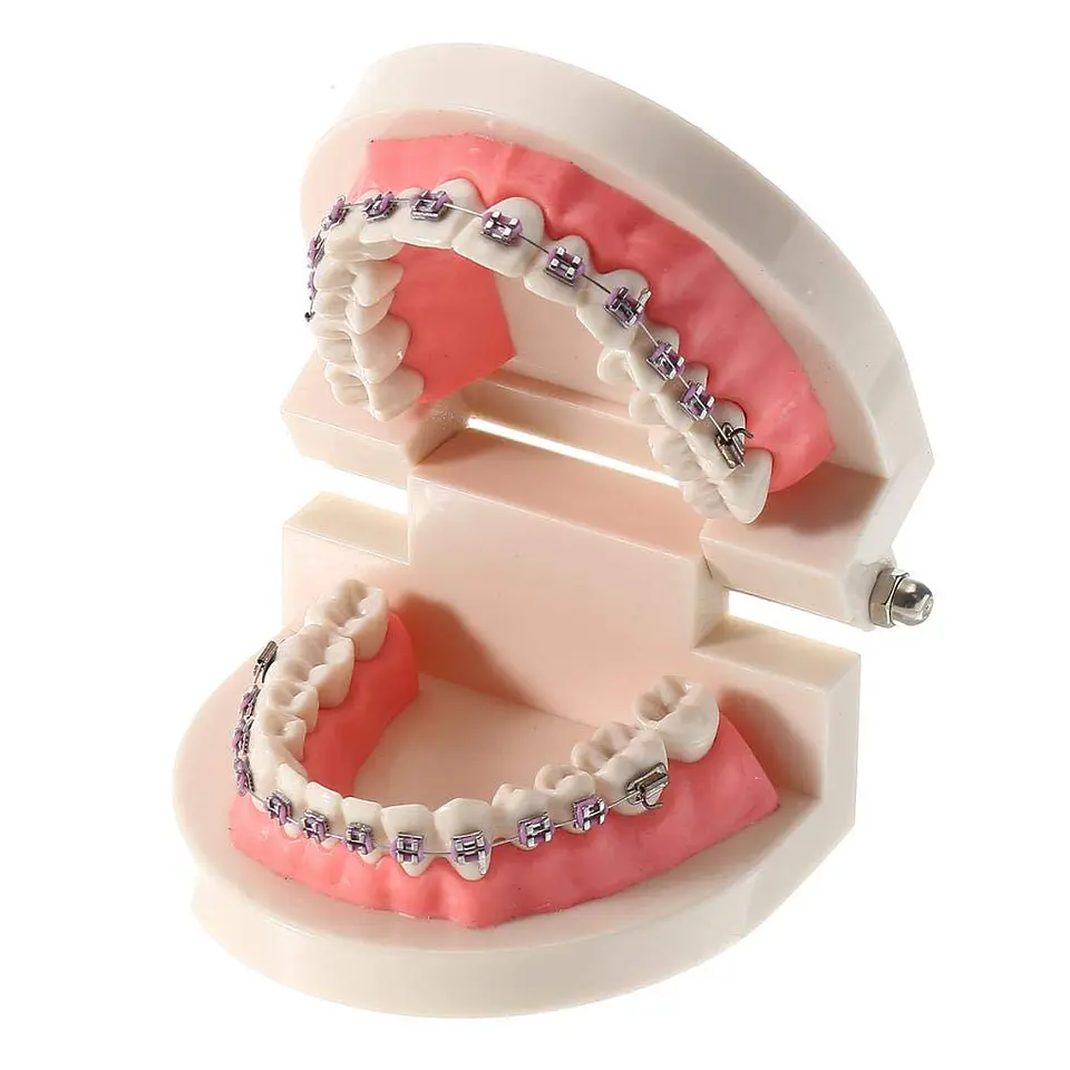 Arcada Modelo Dental Bracket Odontología Dientes Ortodoncia 4