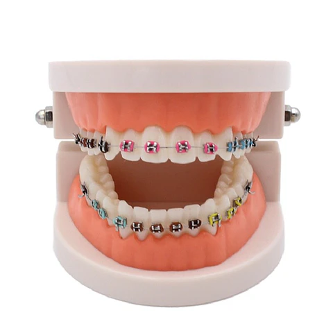 Arcada Modelo Dental Bracket Odontología Dientes Ortodoncia