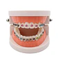 Arcada Modelo Dental Bracket Odontología Dientes Ortodoncia - Miniatura 1